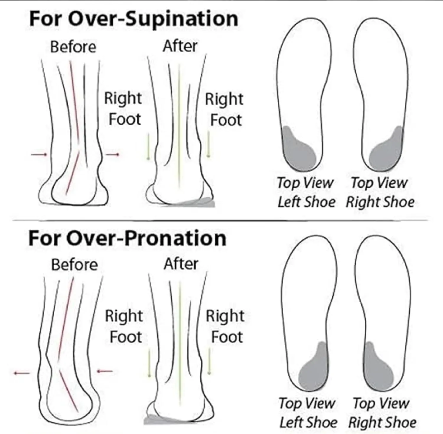 2025 New Women's Soft Sole Mesh Comfort Orthopedic Shoes, Low-top Flat Arch Support Walking Shoe, Comfortable Walking Shoes Women Arch Support