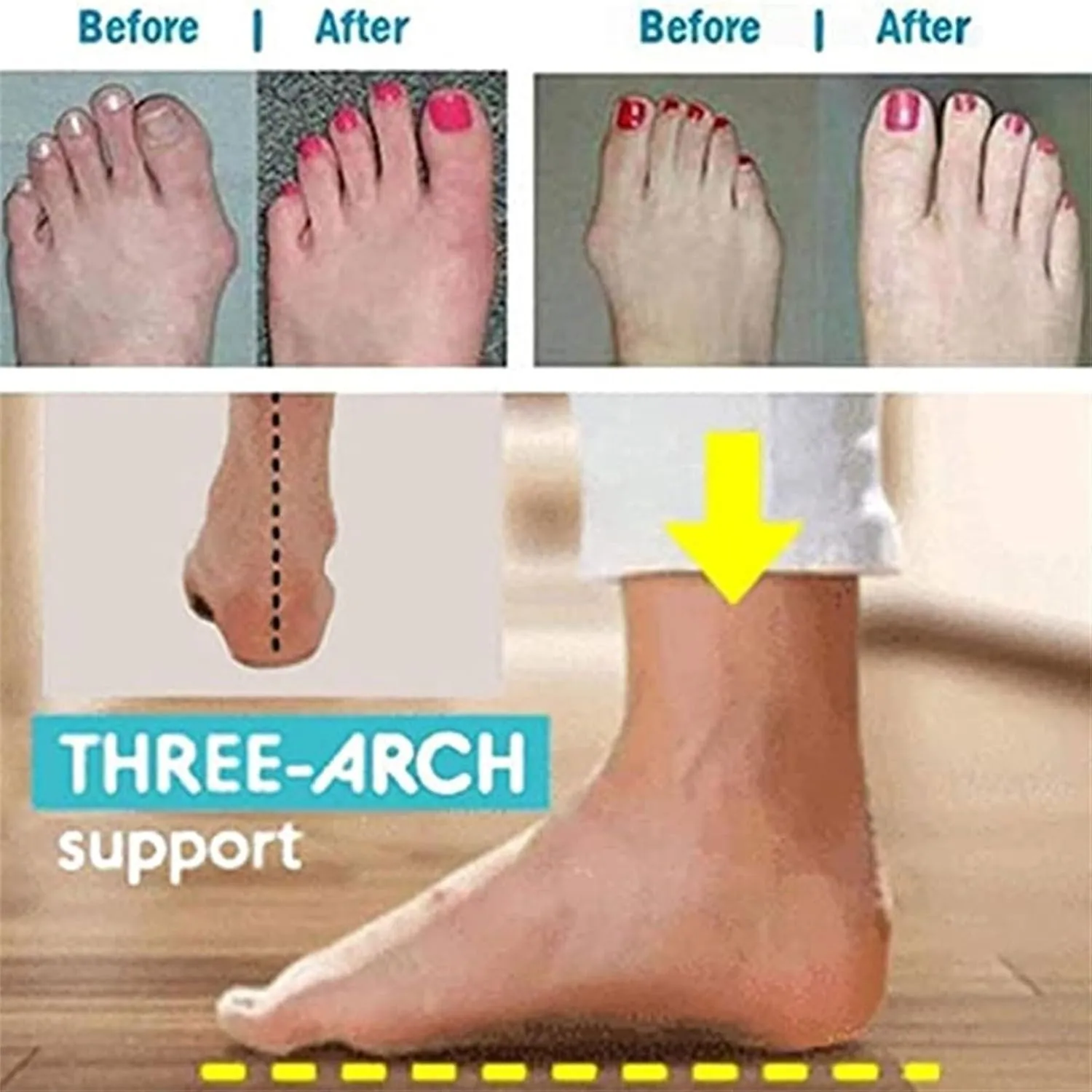 Yytcsjz Women'S Orthopedic Sandals, Fashion Slip On Soft Cushion Comfort Open Toe Flat Sandals, With Arch Support, For Beach Travel Summer